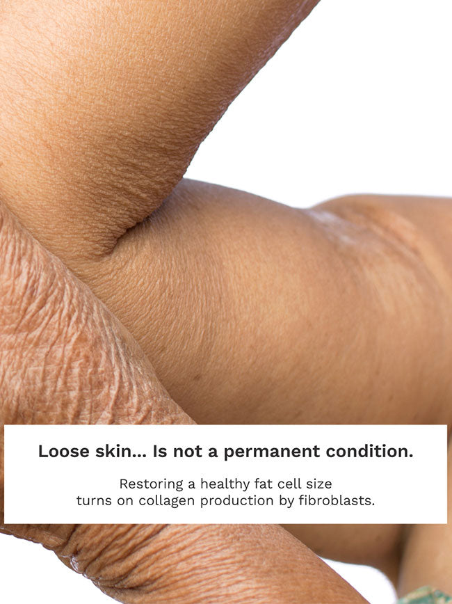 Before and after Adipeau Strength Gel, skin laxity on upper arm improves with consistent use