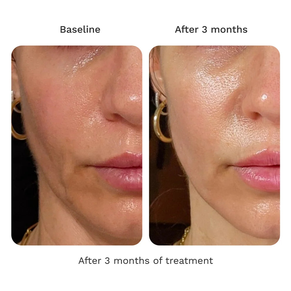 Before-and-after comparison of a woman&